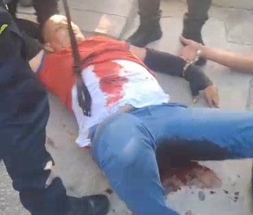 (2)Two criminals arrested by police one of the got a shoot in the ass