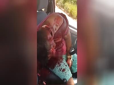 man cut by machete inside car