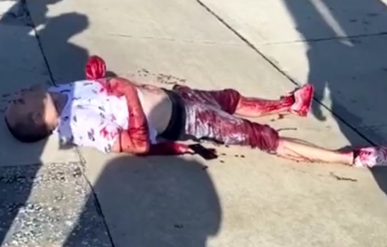 Man stabbed in broad daylight