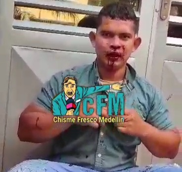 Thief saved by police from angry crowds 