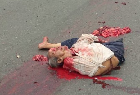 Old man gored by big truck 