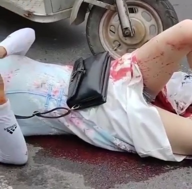 Woman Stabbed Laying in Pool of Blood