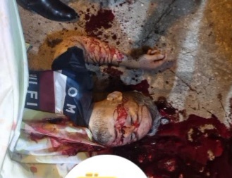 Young man gets a fatally headshot 