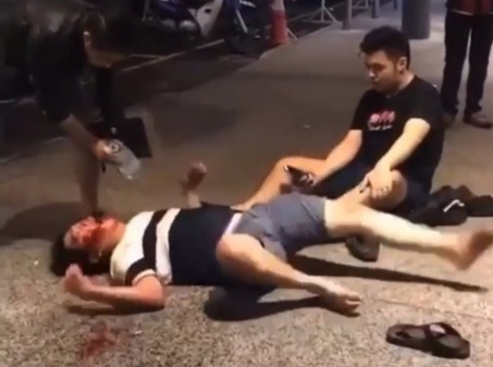 Man Horribly Convulsing after Falling on his Head