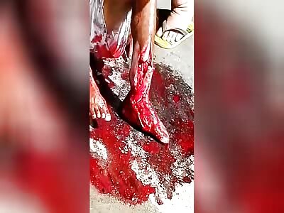 Man Fully Awake After Surviving Gruesome Bike Crash