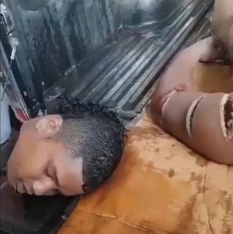 Chopped With Machete In Ecuador.