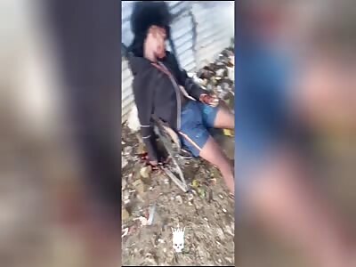 Hitmen woke up a young man early and gave him multiple shots