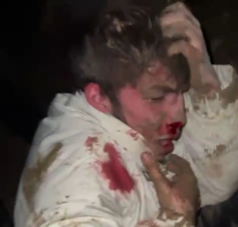 Russian Addict Punished HARD for not Paying Debts 