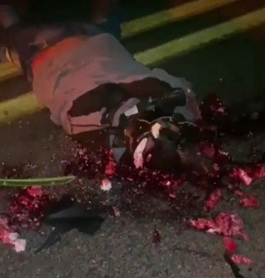 Motorcyclist died in an horrific accident his brain is on the asphalt 