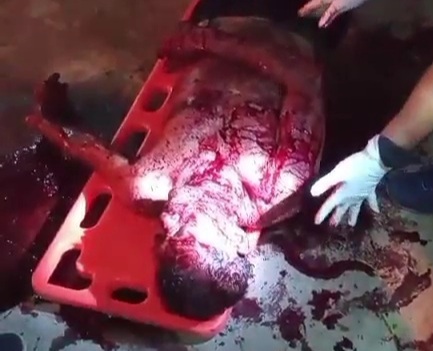 Gangster attacked by rival using machete 