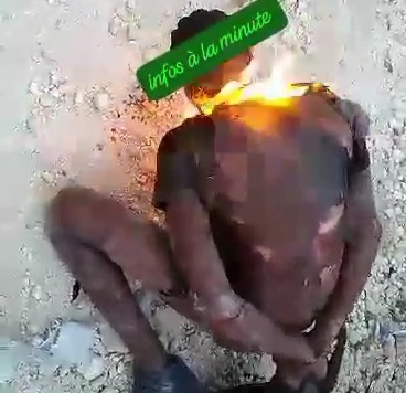 HAITIAN GANG BURNING RIVALS HEADS ALIVE 