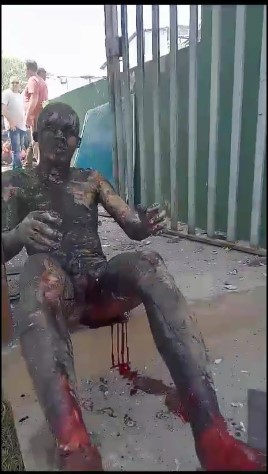 Horrible, accident in jundiai brazil, charred people