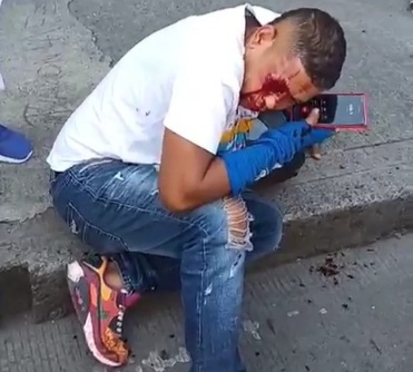 Motorcyclist shoot in his eyes after failed robbery of his bike 