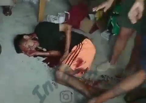 Young man victime of sicario shooting 