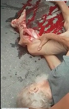 Old man had his leg demolished