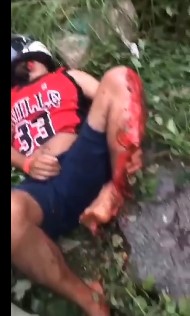 Brazilian Biker Finds Out What Pain Truly is