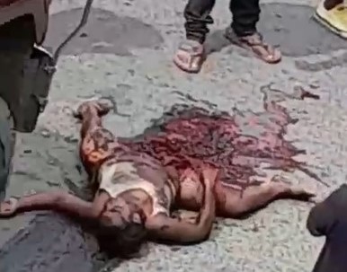 Oh my God, woman turned into a living pancake