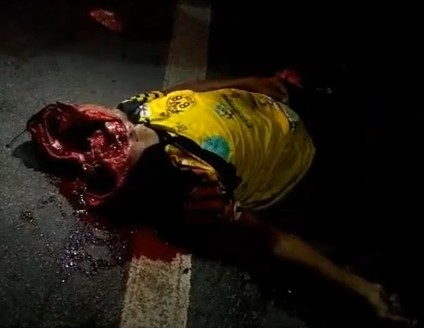 Man has his Face Destroyed in Accident 2