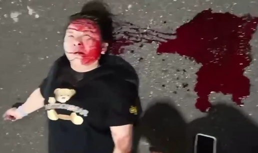 Woman convulsing after horrific motorcycle crash 