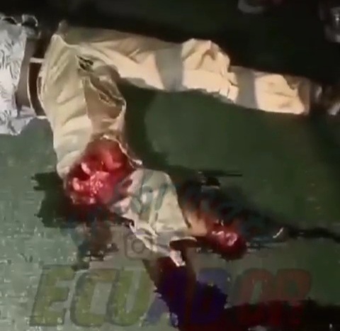 Horrific accident leaves man with crushed leg