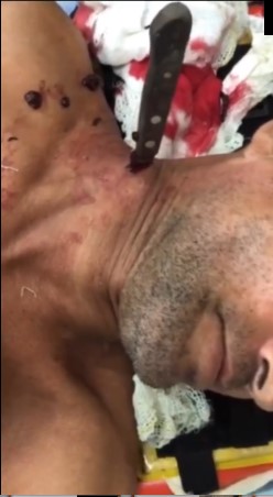 man with his knife stuck in his weight