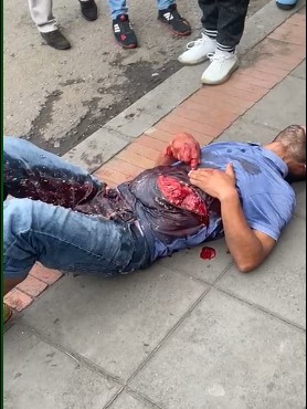 OMG, Victim Holds his Guts in so They Don't Leave.