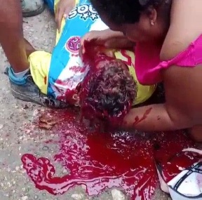 Young man killed by fatally headshot from sicario 