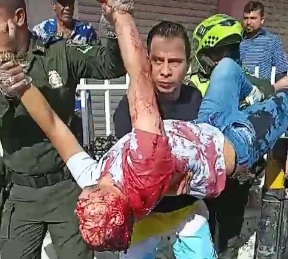 Young man shoot dead by sicario in during party in cartagena colombia 