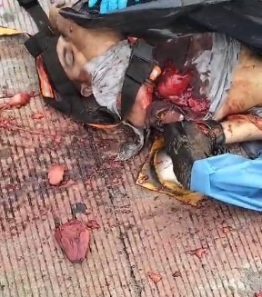 Accident with fatal victim left the victim dismantled and heart ripped