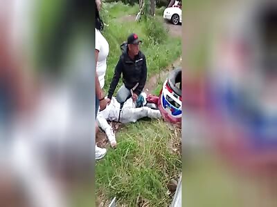 Federal highway Mexico - Cuernavaca, a man lost his foot and part of his leg when he suffered a motorcycle accident.