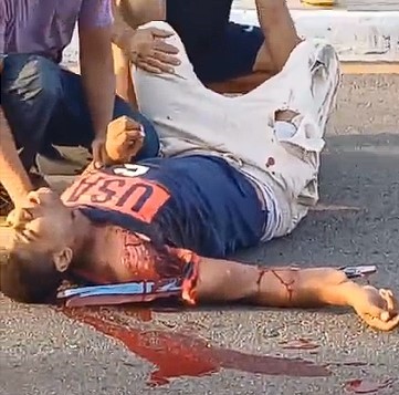 the biker had an iron bar stuck in his collarbone