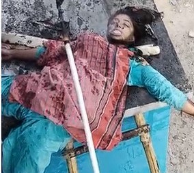 Water Cannot Revive Electrocuted Woman.