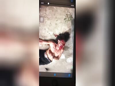 man dying after headshot accident