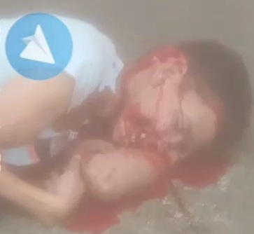 Another Ecuadorian sicarios victim shoot dead in the face 