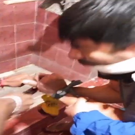 Fingers Cut Off Before Demanding a $500,000 Ransom