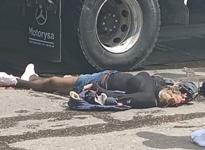 Woman's Scull Crushed in Horrific Motorcycle Accident.