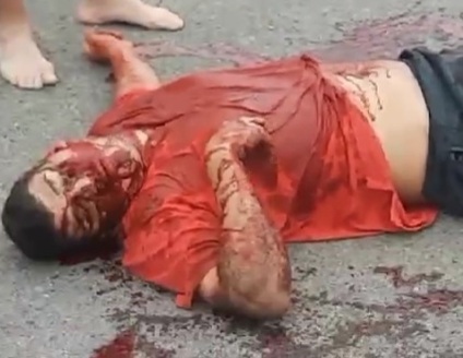 Local Drug Dealer Shot by Rival 