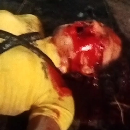 Cute Girl's Face Turned Into Ugly Face of Death