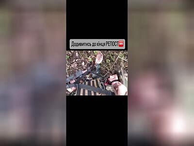 Russian soldier got injured! 