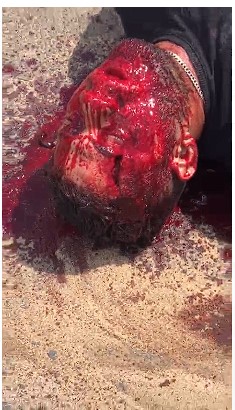 OMG, Dude in Total Agony and is One big Bloody Mess