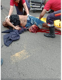 biker had his leg severed in horrible accident