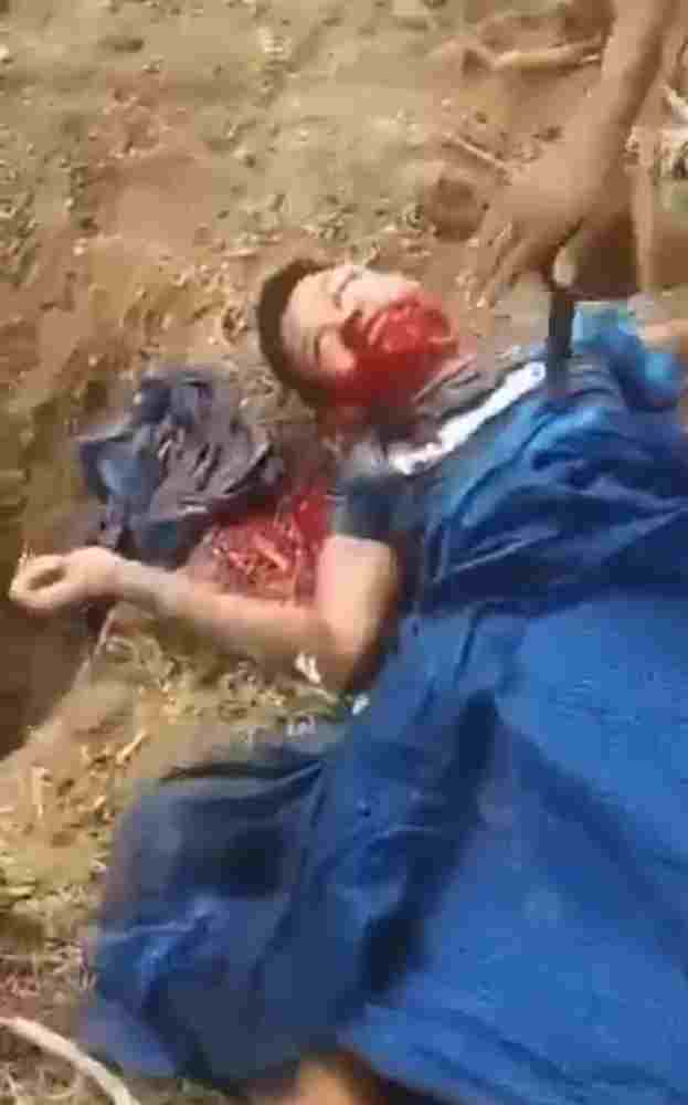 Rebels Savagely Hack A Man To Death Then Knife Him In The Heart 