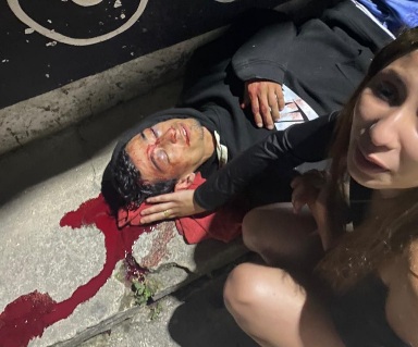 Horrific motorcycle accident 