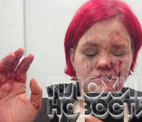 taxi driver beat girl because he didnt like the bills she used to pay