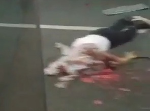 [BRAIN ON THE ASPHALT] MOTORCYCLIST SKULL CRASHED 