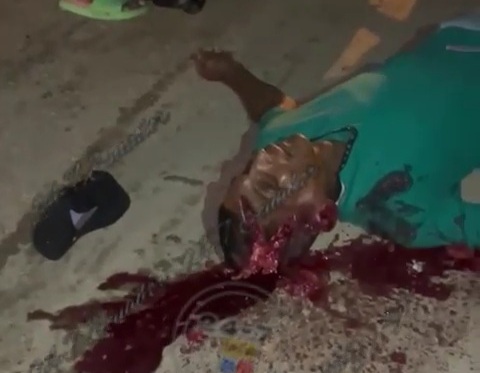 [BRAIN ON THE ASPHALT]VICTIM OF SICARIO KILLED BY MACHETE TO THE HEAD 