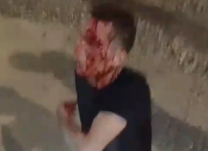 Thief punished hard by angry crowds 