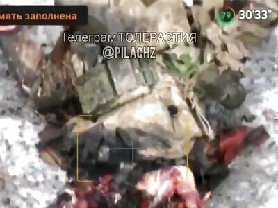 Ukrop agonizing over minor leg pain 