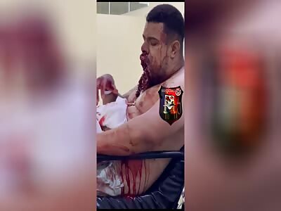 victim of attempted murder