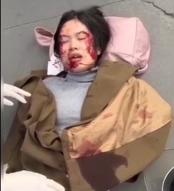 Two girls on moped crashed one dead and the other badly injured 